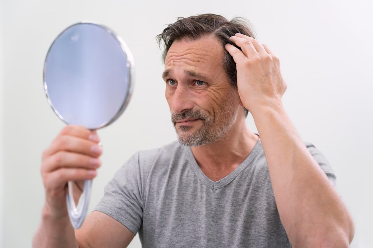 raisons de la chute des cheveux